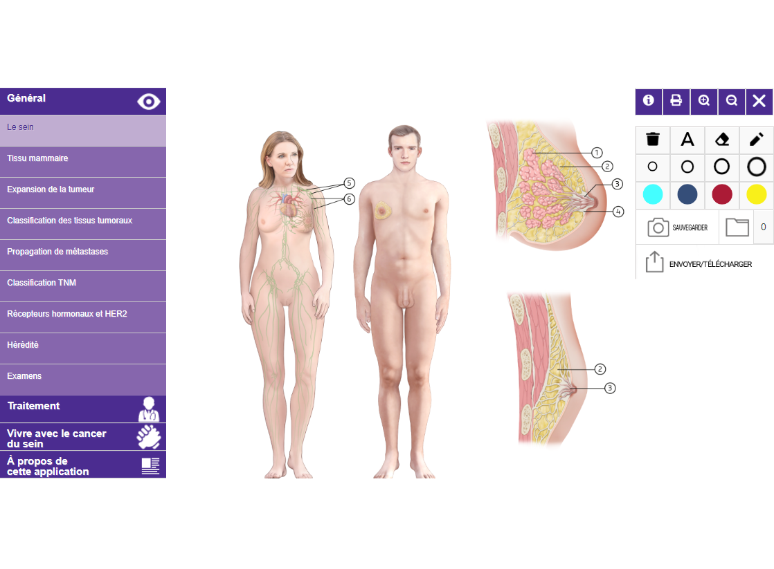 L’Atlas Du Cancer Du Sein